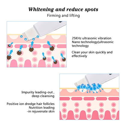 SonicSkin Pore Vacuum Cleanser